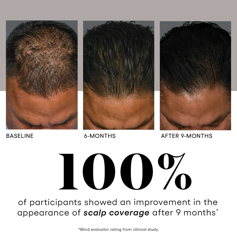 Plated - HAIR Serum