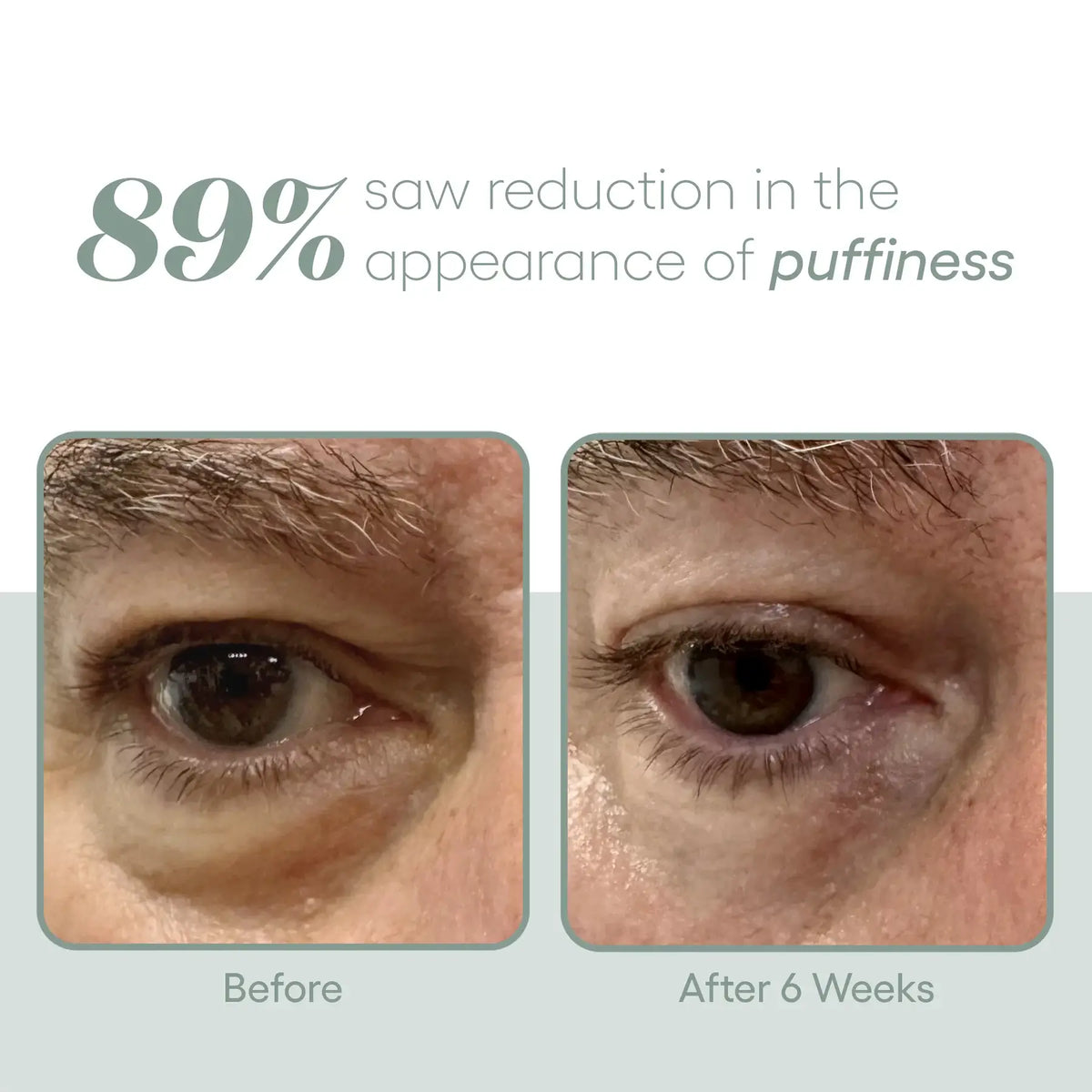 Plated - EYE Serum